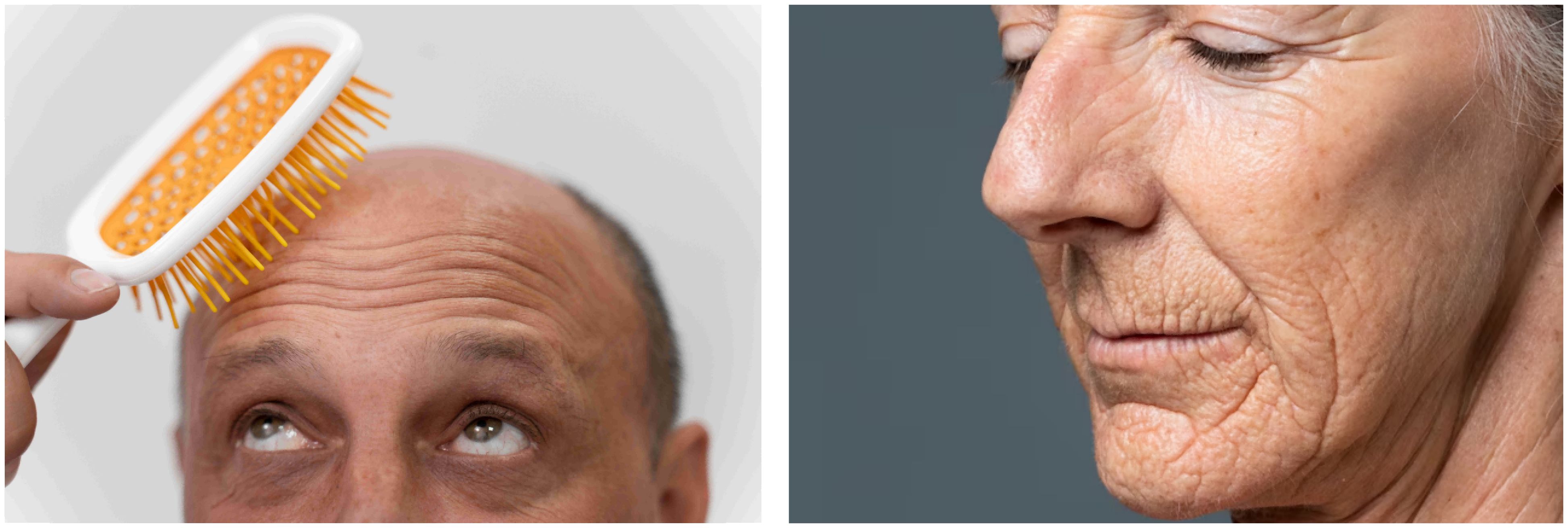 skin-diseases.png